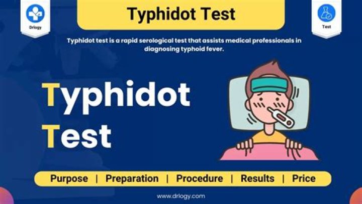 How do I know if my typhoid test is positive?