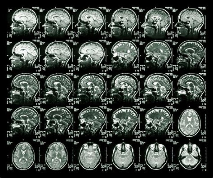 What does a brain MRI with contrast show?