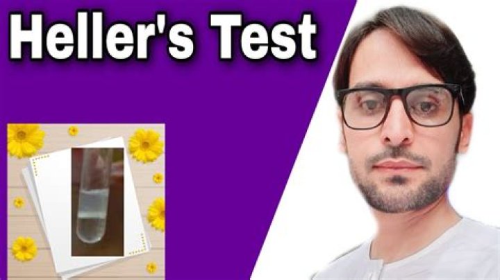What is the Heller test?